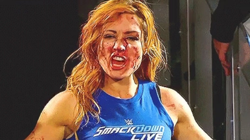 FUSION PREMIERE  Becky-lynch-busted-open-on-raw