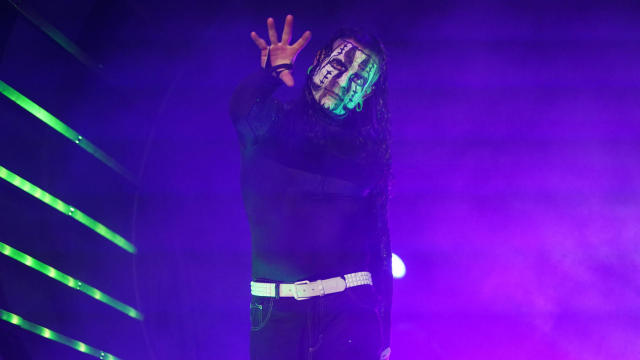 Jeff Hardy scheduled for brain scan